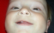 Felix’s third tooth